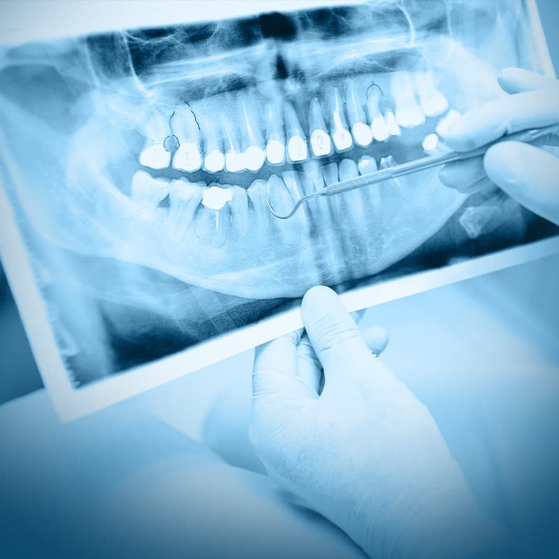 Curso: Aperfeiçoamento em Endodontia — Aperfeiçoamento