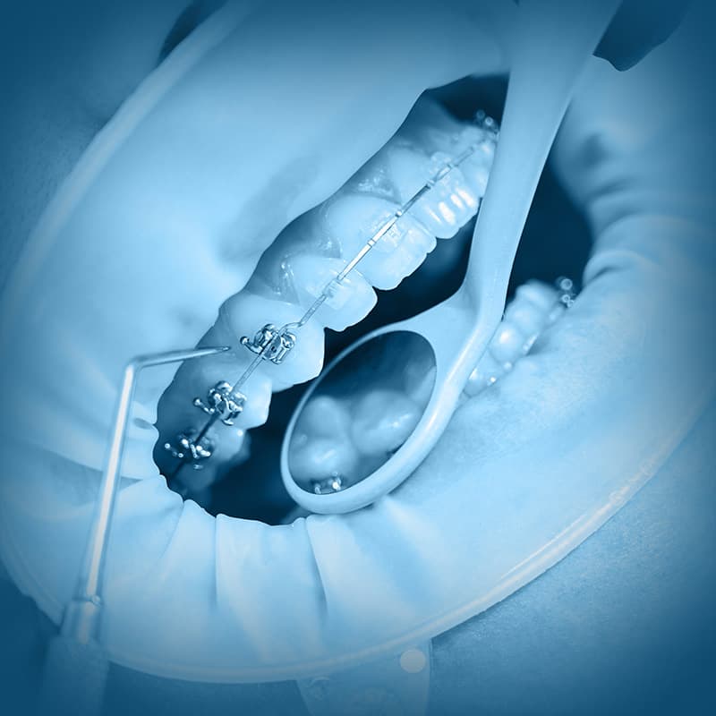 Curso: Periodontia com Ênfase em Microcirurgia Plástica Periodontal e Peri-Implantar — Aperfeiçoamento