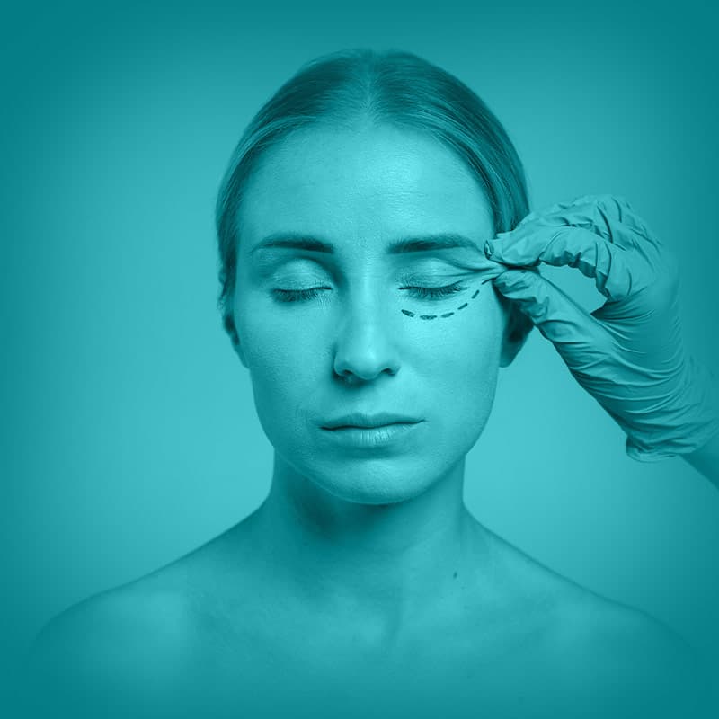 Curso: Blefaroplastia — Imersão