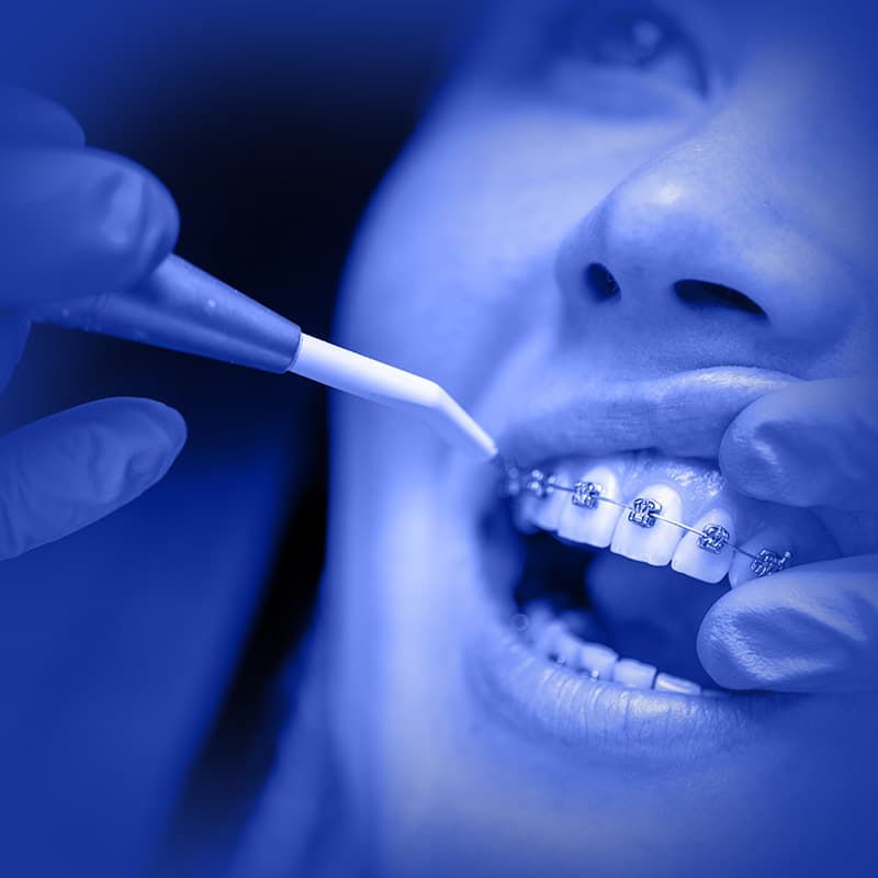Curso: Excelência em Ortodontia — Atualização