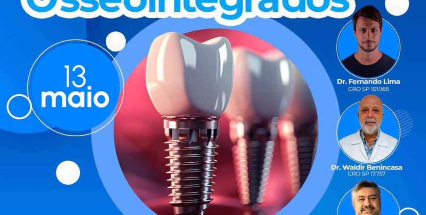 implantes-osseointegrados