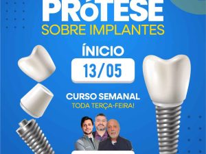 Prótese sobre implante