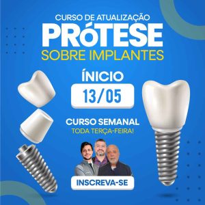 Prótese sobre implante