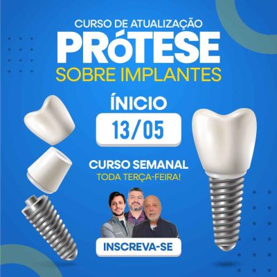 Prótese sobre implante